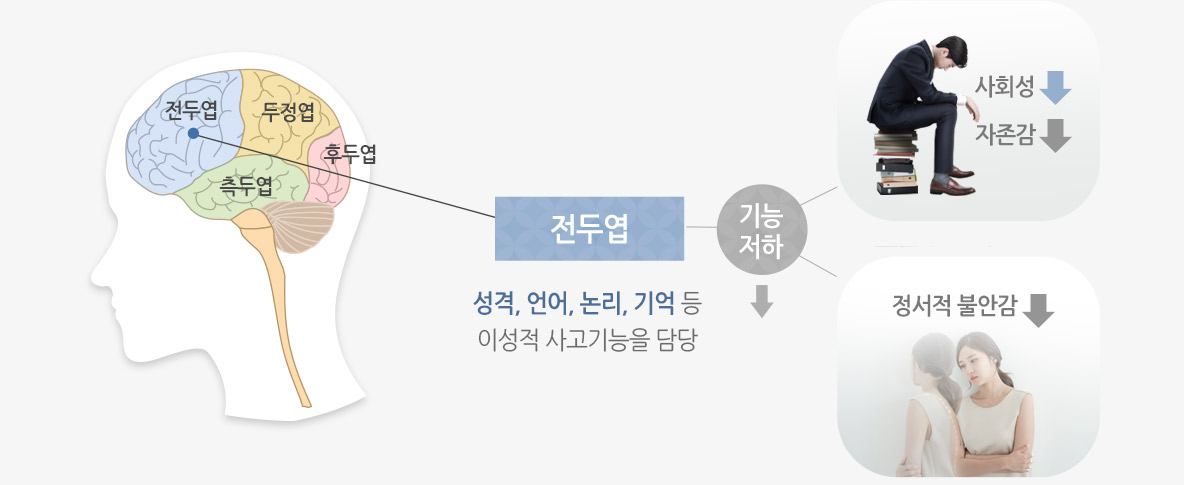 전두엽: 성격, 언어, 논리, 기억 등 이성적 사고기능을 담당, 사회성, 자존감 하락, 정서적 불안감 내려감