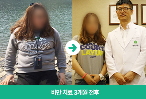 변한의원 비만 치료 3개월 전후 이미지