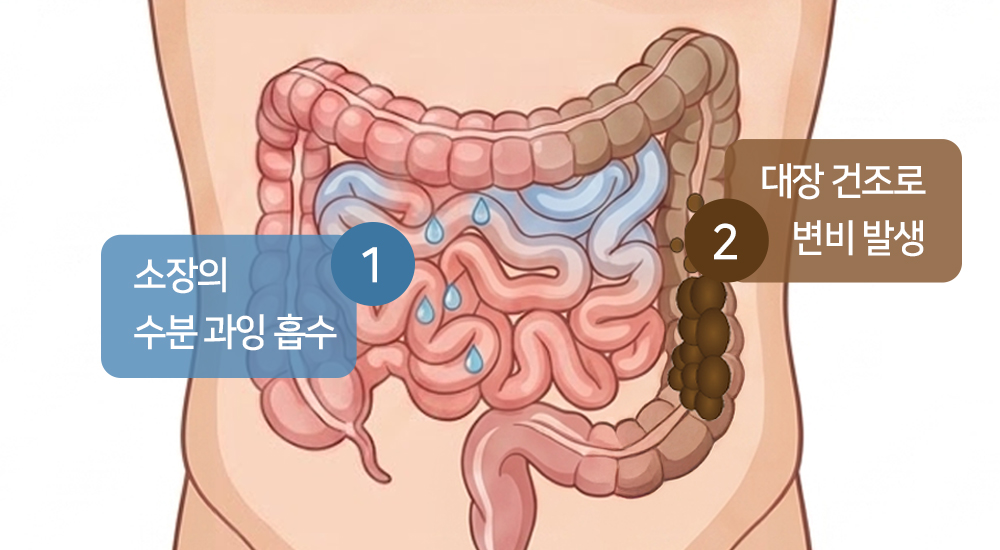 소장의 수분 과잉 흡수, 대장 건조로 변비 발생, 변한의원 변비 원인 이미지, 변비가 되는 과정 이미지