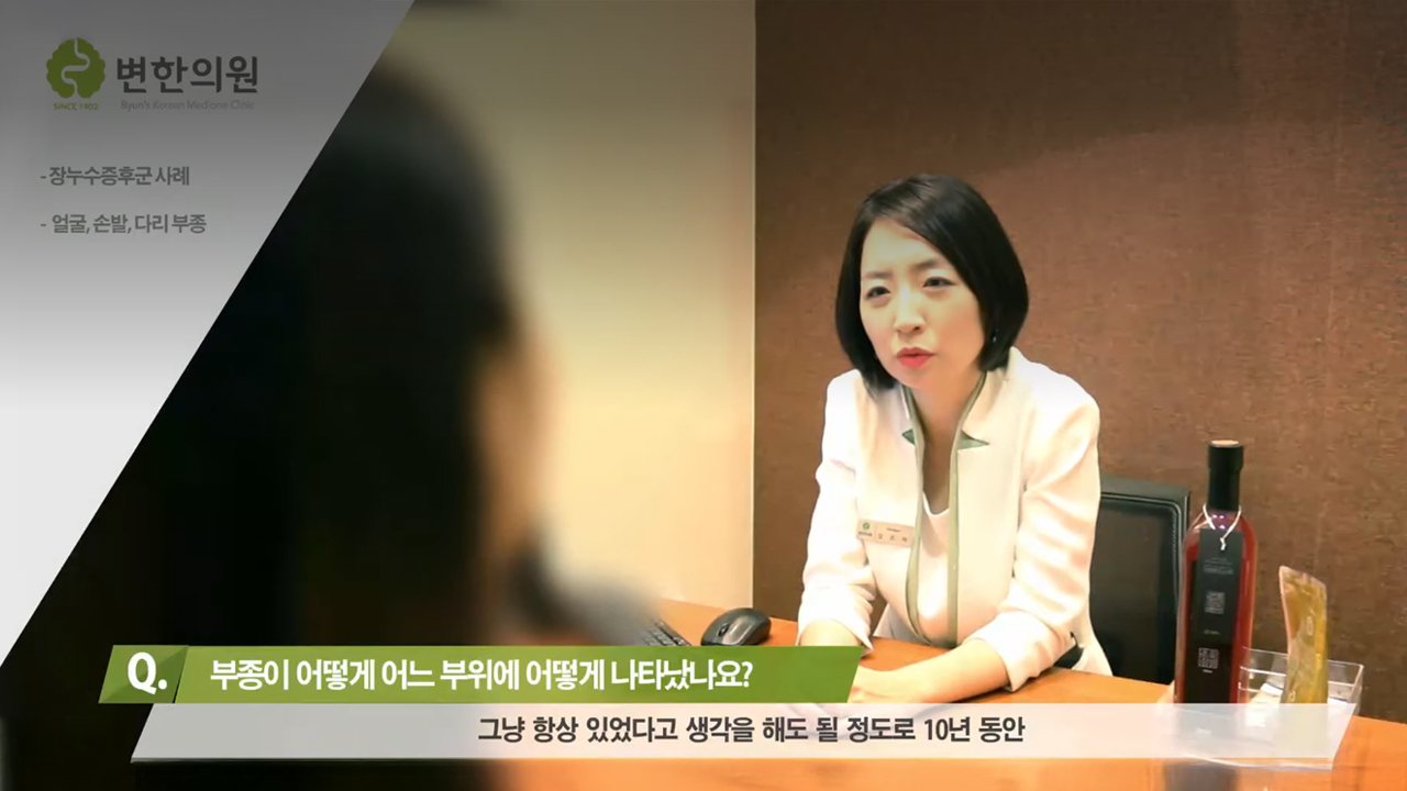 [변한의원] 얼굴, 손발, 다리 부종 원인, 자율신경실조증 치료 후기 섬네일