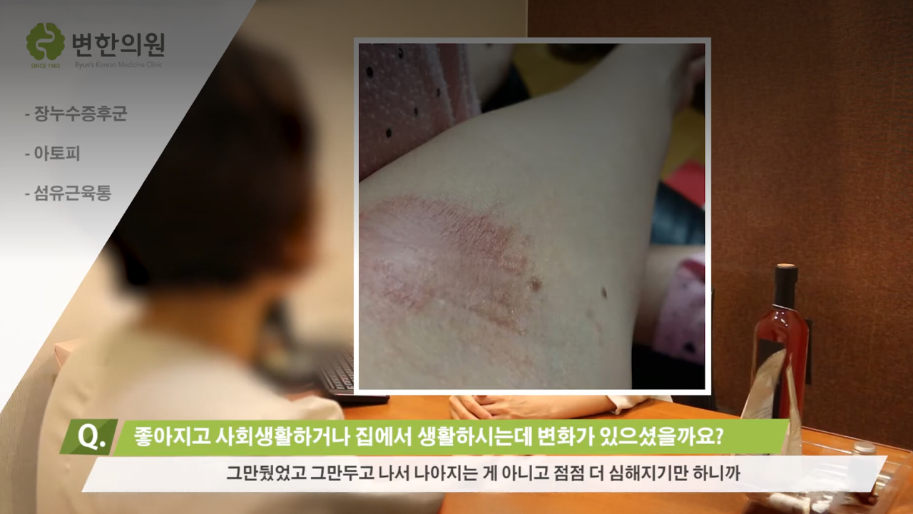 아토피, 섬유근통 치료 후기 섬네일