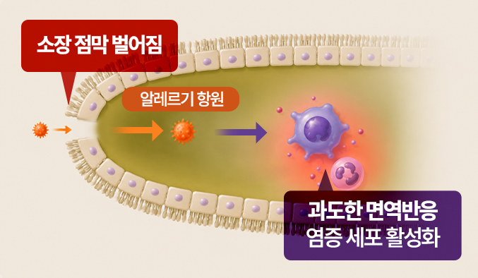 소장 점막 벌어짐, 알레르기 항원 침투, 과도한 면역반응 염증 세포 활성화