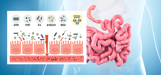 소장 문제로 인한 장누수증후군 