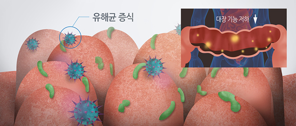 설사 디자인 이미지