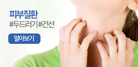 피부질환 #두드러기 #건선