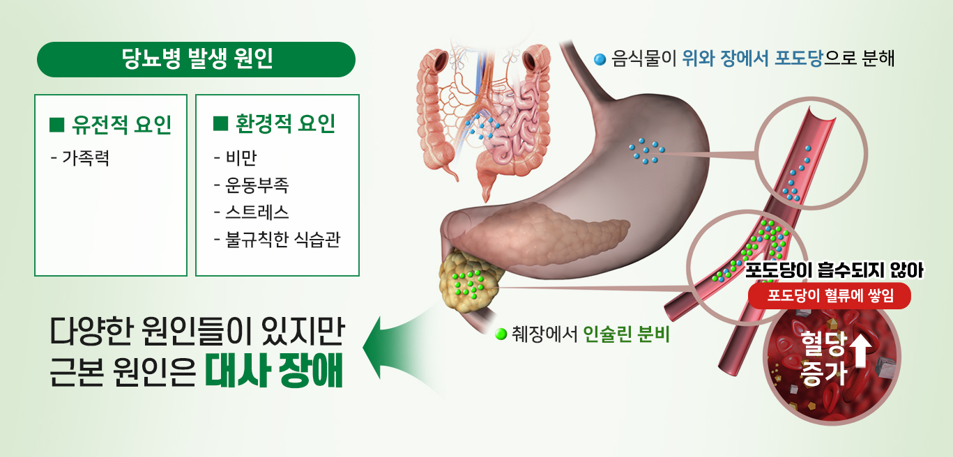 당뇨병 발생 원인 유전적 요인: 가족력, 환경적 요인 : 비만, 운동부족, 스트레스, 불규칙한 식습관, 당뇨병 발생 과정 : 음식물이 위와 장에서 포도당으로 분해, 췌장에서 인슐린 분비, 포도당이 흡수되지 않아 포도당이 혈류에 쌓임, 그래서 혈당 증가, 당뇨병 다양한 원인이 있지만 근본 원인은 대사 장애