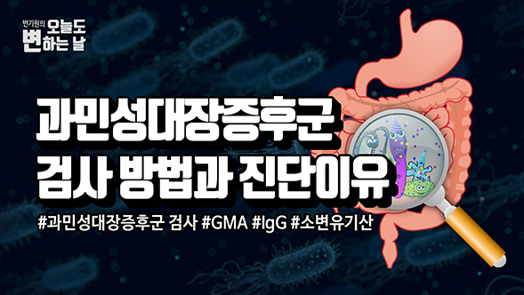 과민성대장증후군 진단 방법