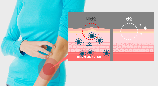 피부 각질이 일어나는 이유 이미지