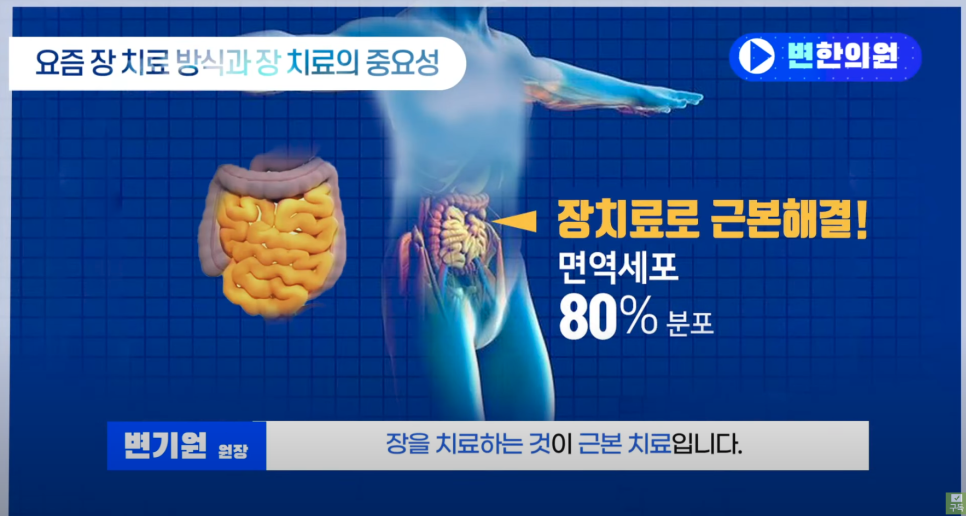 장을 치료하는 이미지