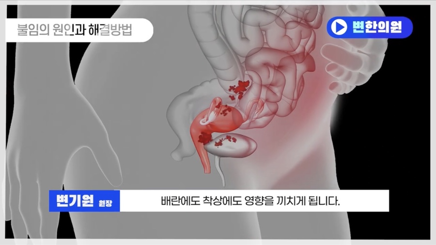 제대로된 임신 한약 처방