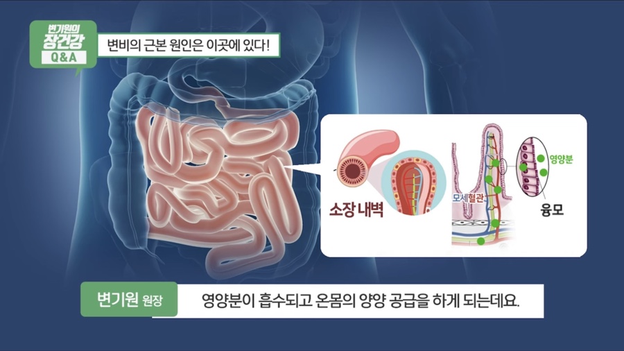 변비 원인 장누수증후군 대치동 변한의원